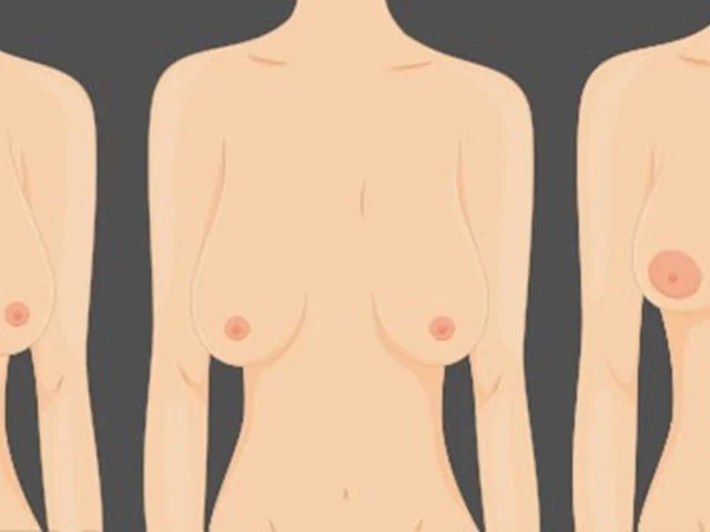 آیا نامتقارن بودن سینه ها نشانه سرطان سینه (پستان) است؟